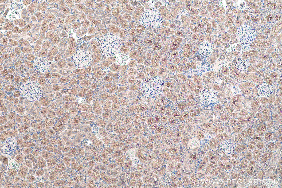 IHC staining of rat kidney using 13288-2-AP