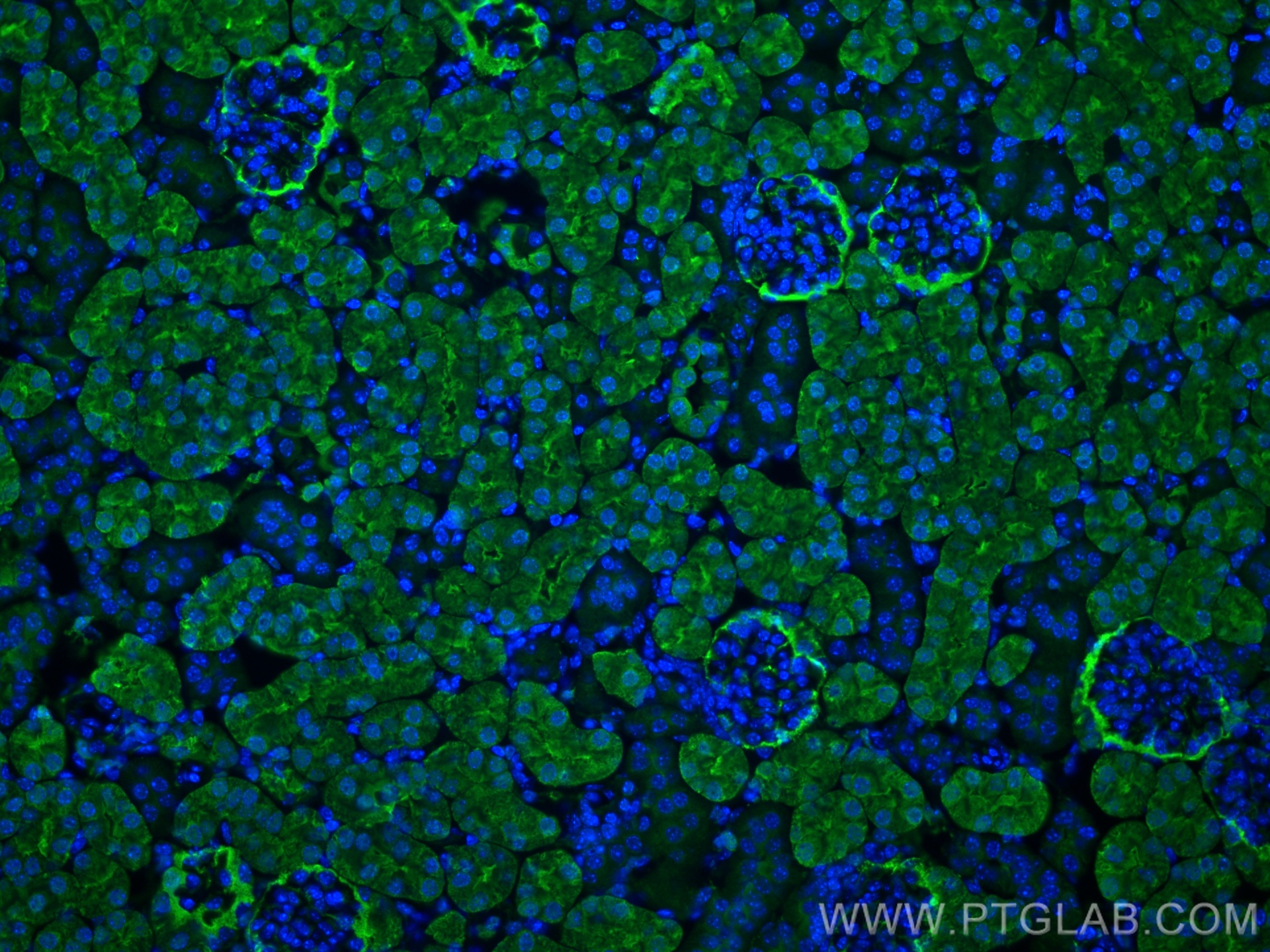 IF Staining of mouse kidney using 67709-1-Ig