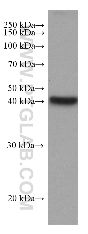 WB analysis of mouse liver using 67709-1-Ig