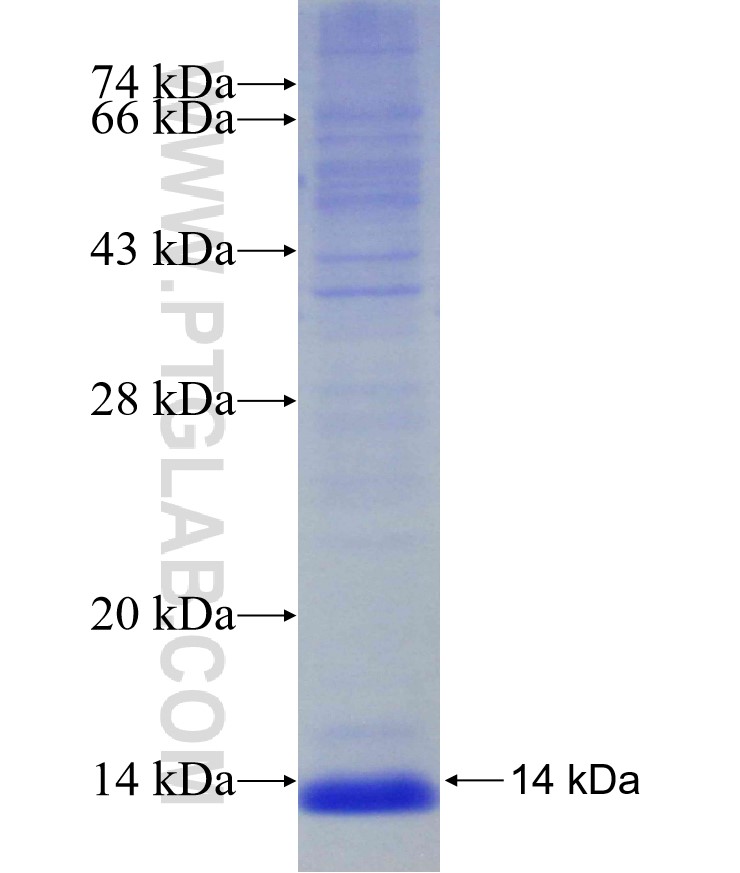 ADH6 fusion protein Ag30494 SDS-PAGE ADH6 fusion protein Ag30494 SDS-PAGE