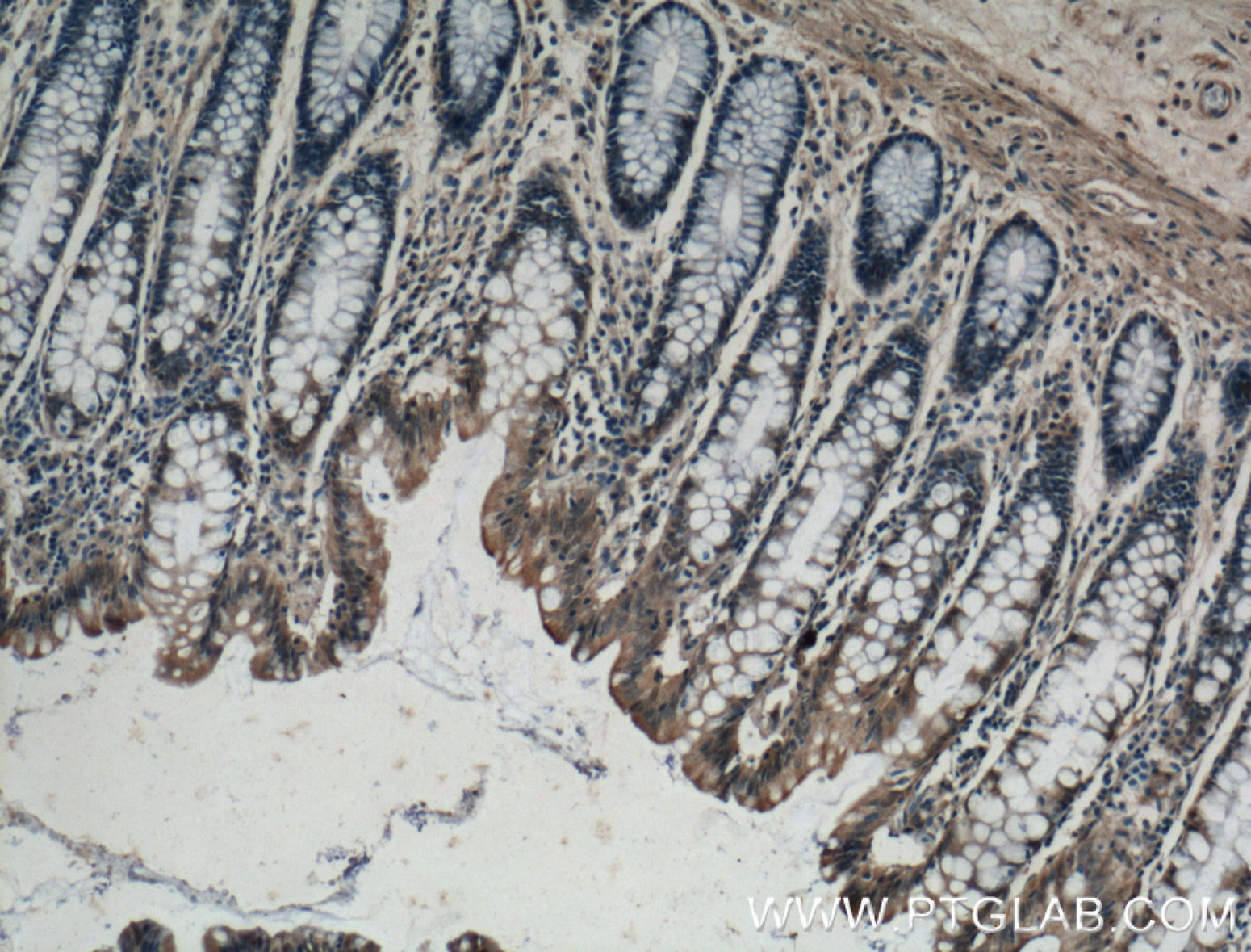 IHC staining of human colon using 14674-1-AP