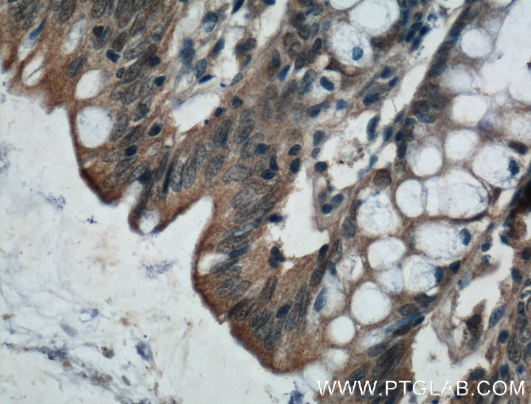 IHC staining of human colon using 14674-1-AP