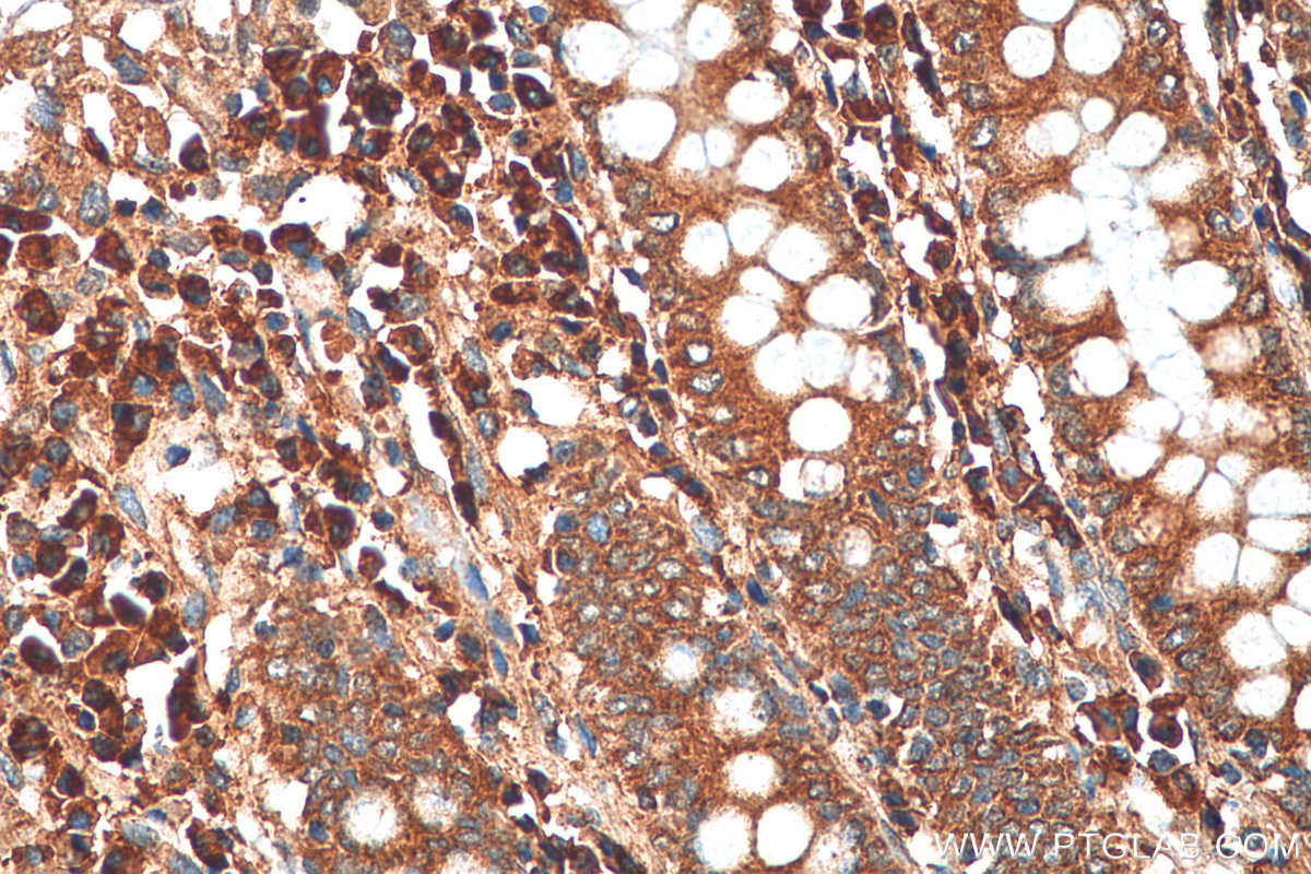 IHC staining of human colon using 19359-1-AP