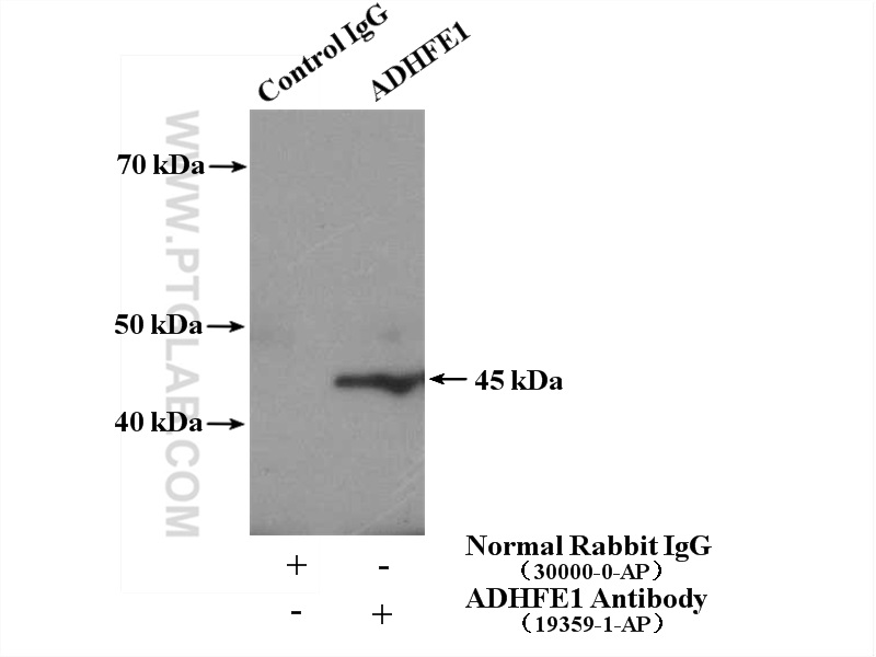 IP experiment of mouse heart using 19359-1-AP