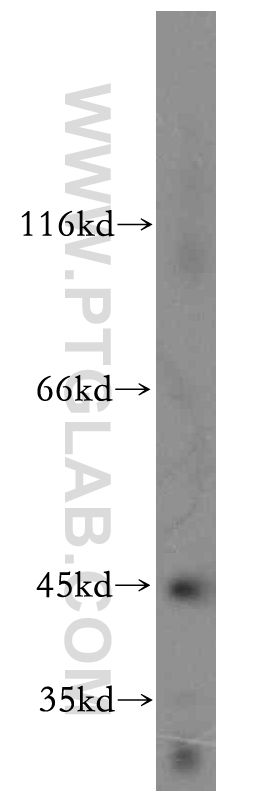 WB analysis of mouse heart using 19359-1-AP