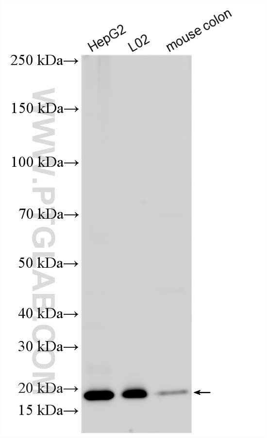WB analysis using 15133-1-AP WB analysis using 15133-1-AP