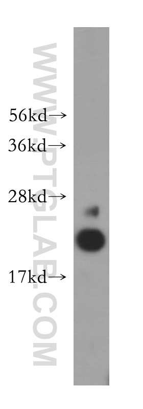 WB analysis of human testis using 15133-1-AP