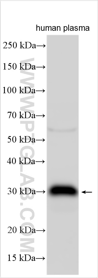 WB analysis using 21613-1-AP