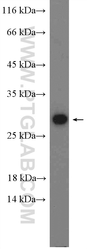 Adiponectin Polyclonal antibody