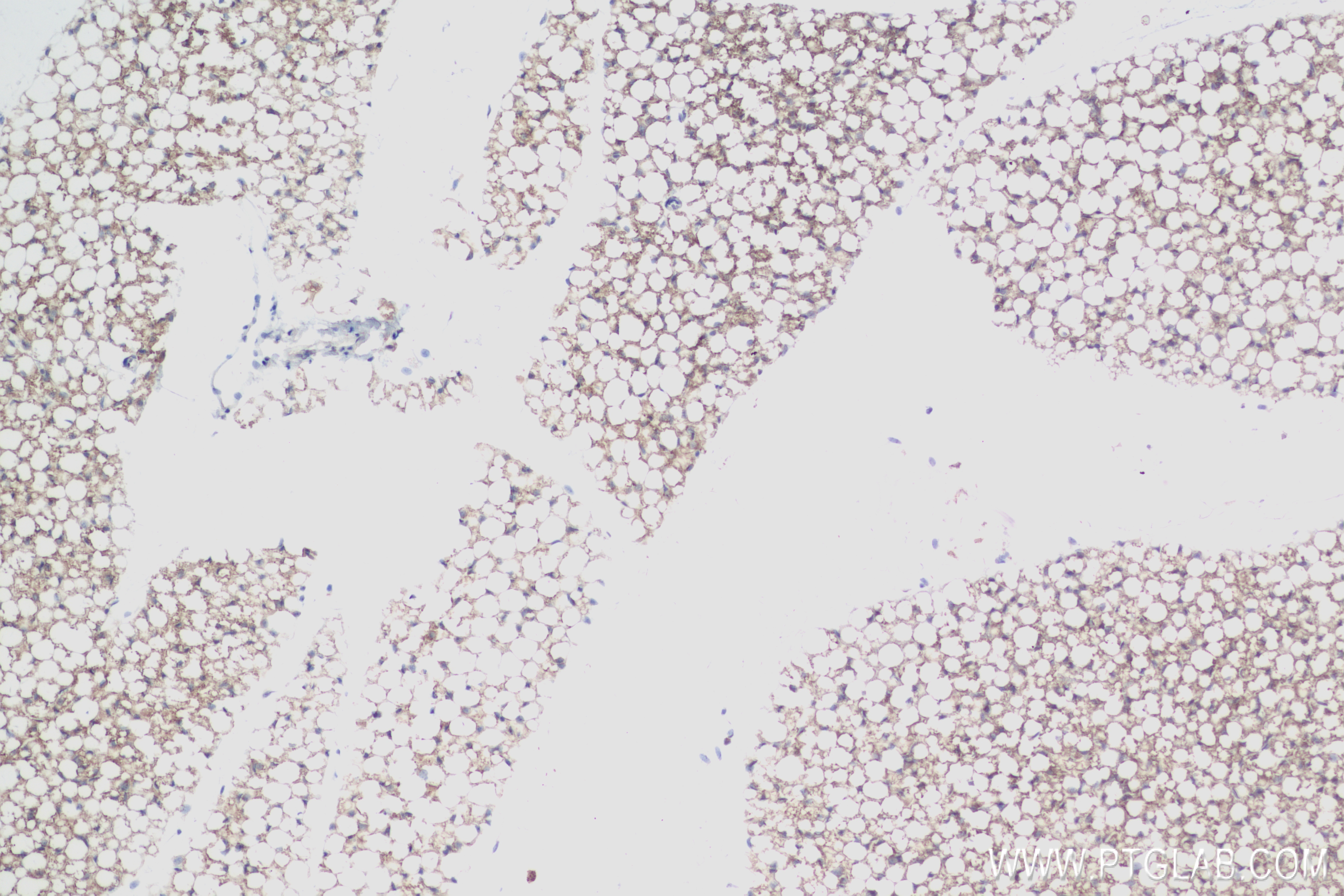IHC staining of mouse brown adipose using 83961-3-RR (same clone as 83961-3-PBS)