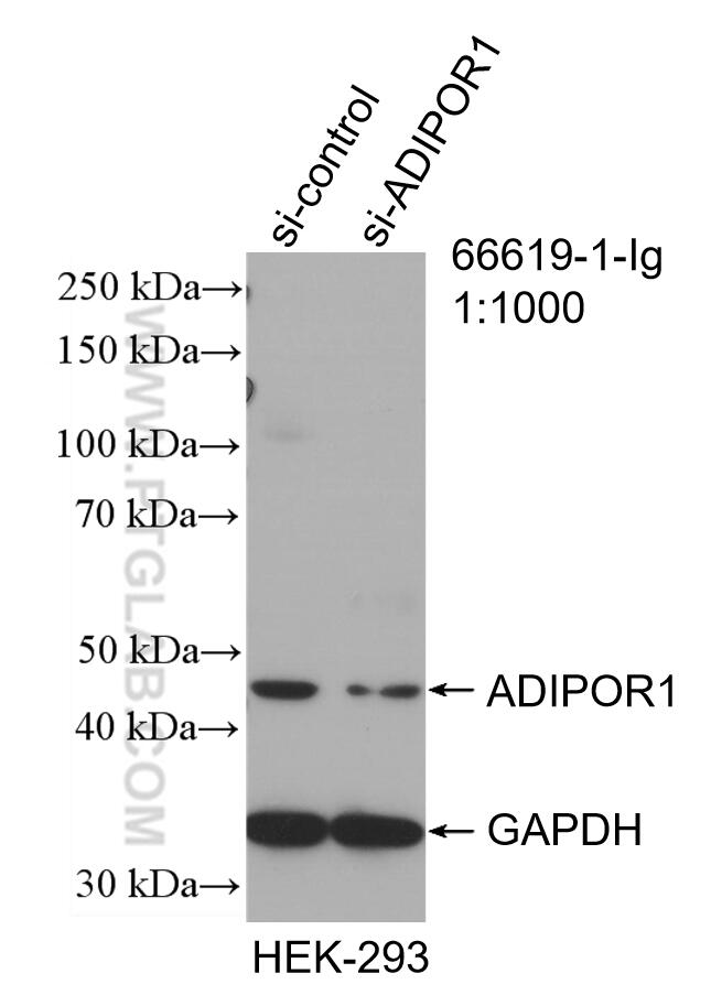 Adiponectin receptor 1