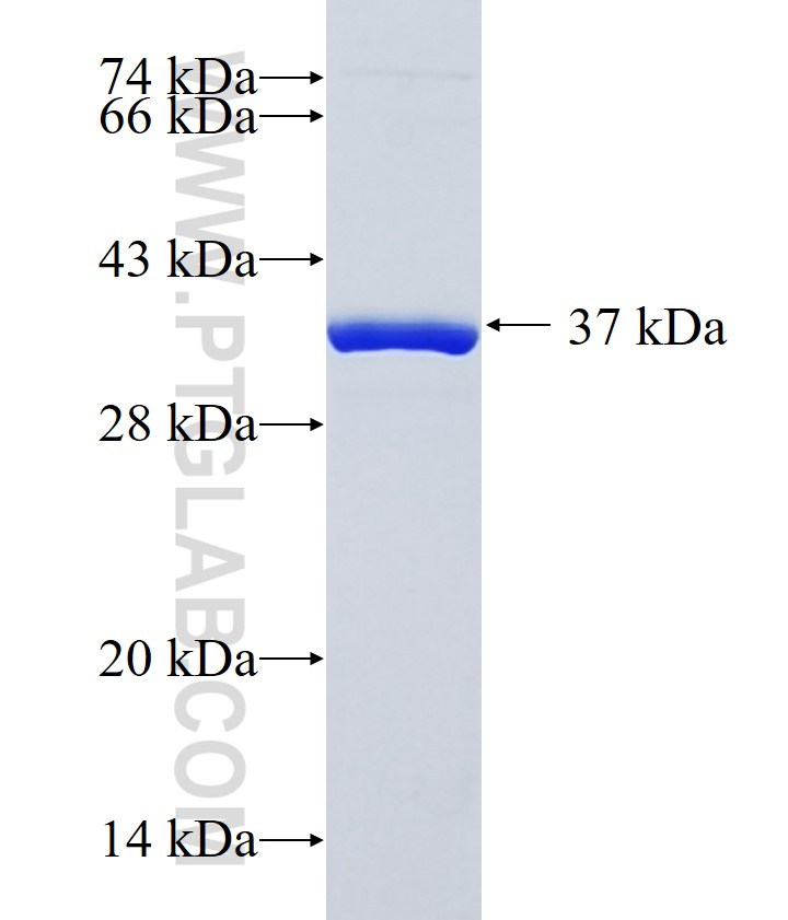 ADIPOR1 fusion protein Ag18187 SDS-PAGE