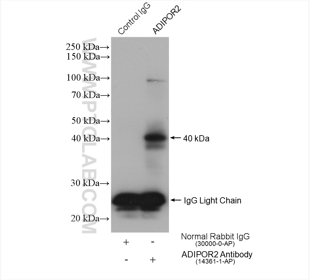 IP experiment of mouse liver using 14361-1-AP