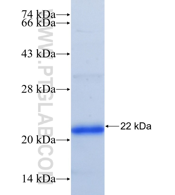 ADIPOR2 fusion protein Ag29883 SDS-PAGE ADIPOR2 fusion protein Ag29883 SDS-PAGE
