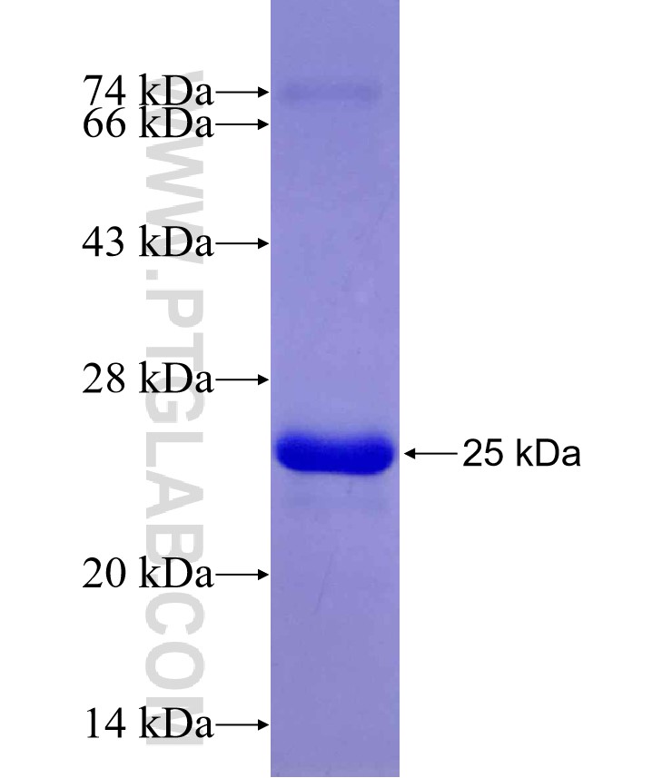ADIPOR2 fusion protein Ag30116 SDS-PAGE