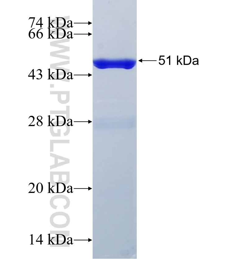 ADISSP fusion protein Ag34862 SDS-PAGE ADISSP fusion protein Ag34862 SDS-PAGE