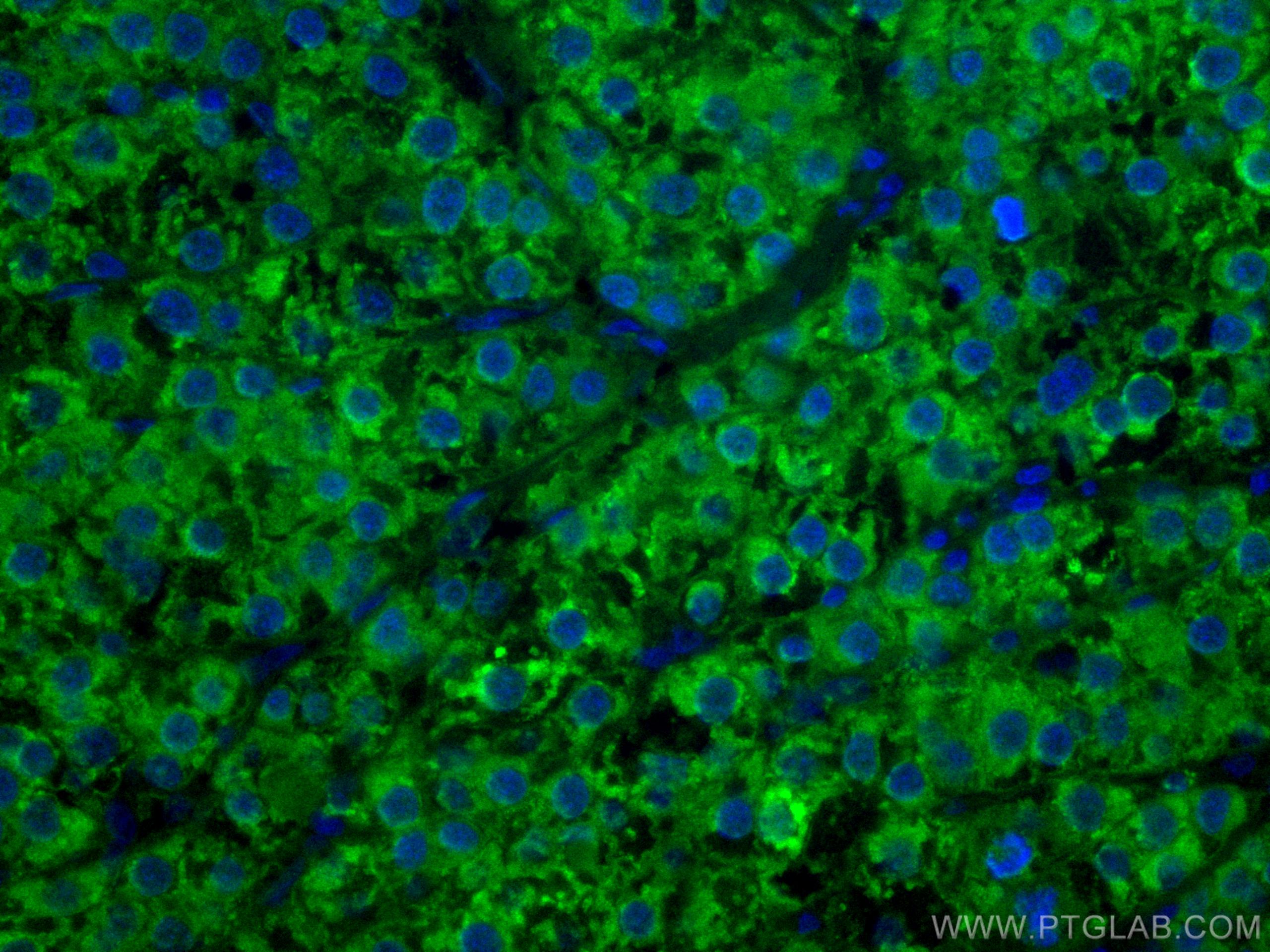 IF Staining of human liver cancer using CL488-66929