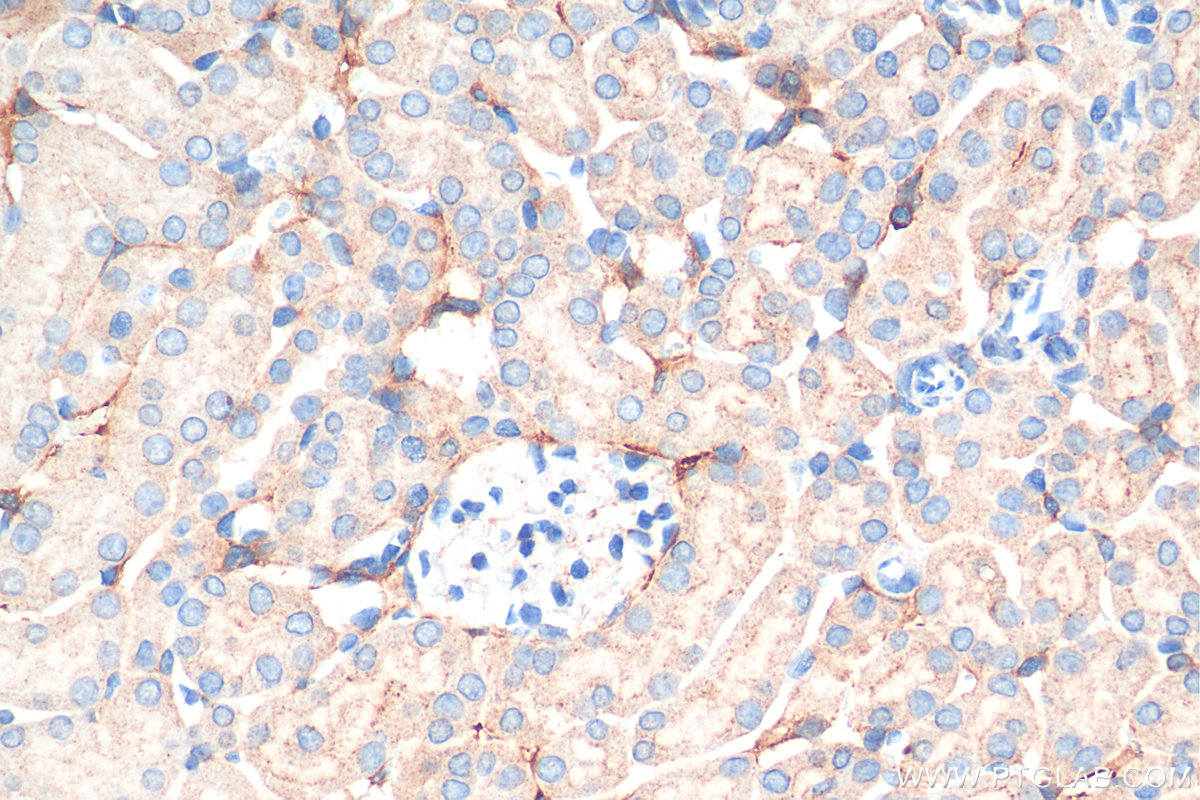 IHC staining of mouse kidney using 10778-1-AP