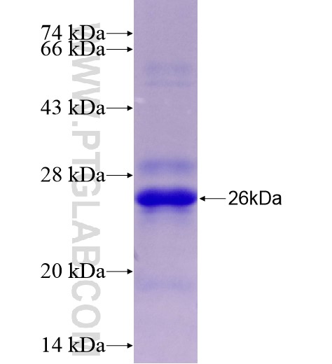 ADM fusion protein Ag28278 SDS-PAGE ADM fusion protein Ag28278 SDS-PAGE