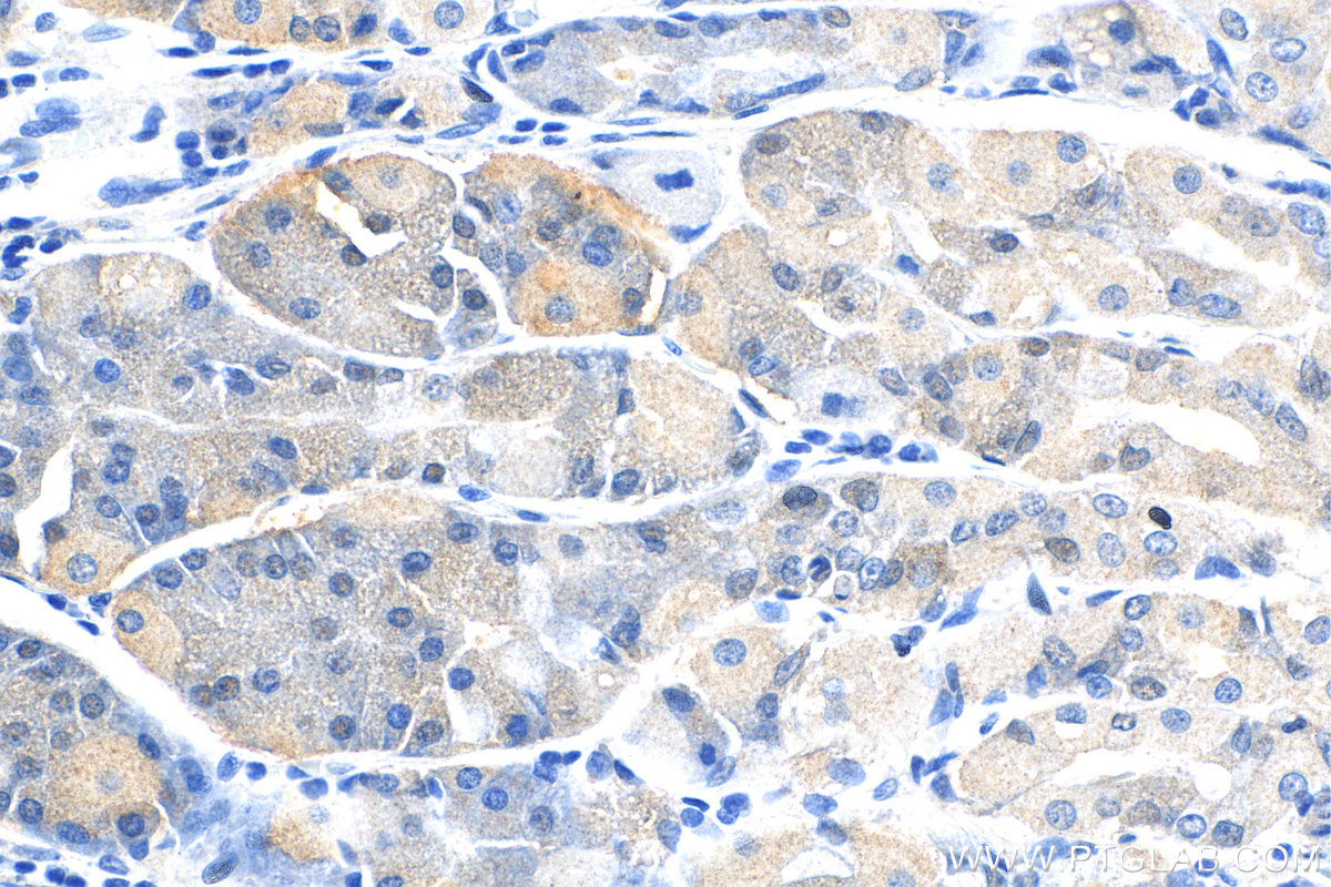 IHC staining of human stomach using 23781-1-AP