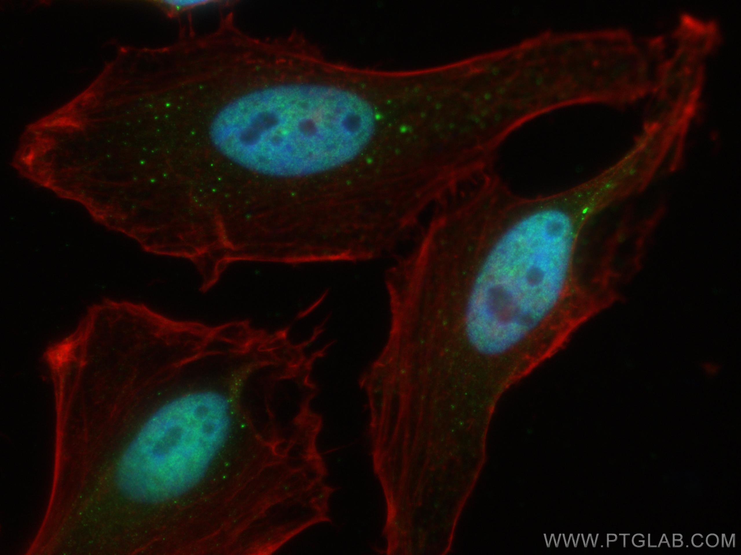 IF Staining of HeLa using 17987-1-AP