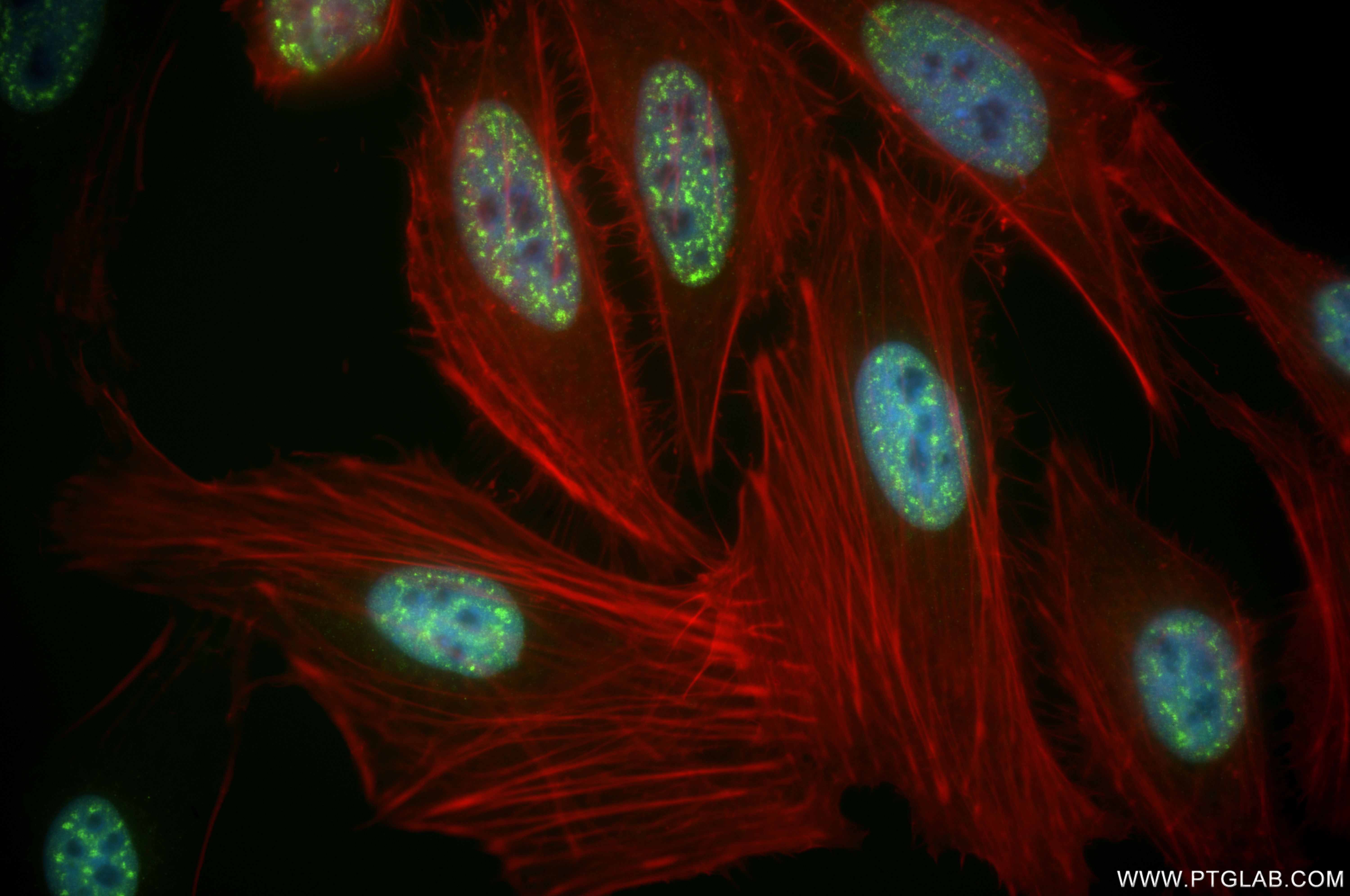 IF Staining of HeLa using 85054-2-RR (same clone as 85054-2-PBS)