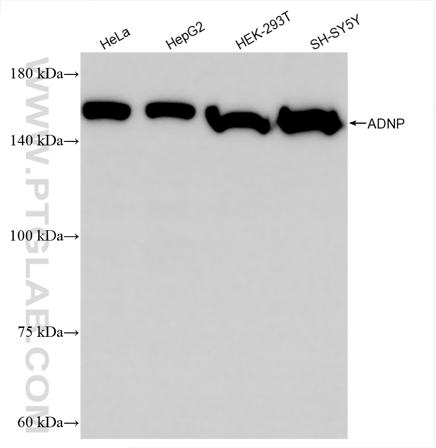 WB analysis using 85054-2-RR (same clone as 85054-2-PBS)