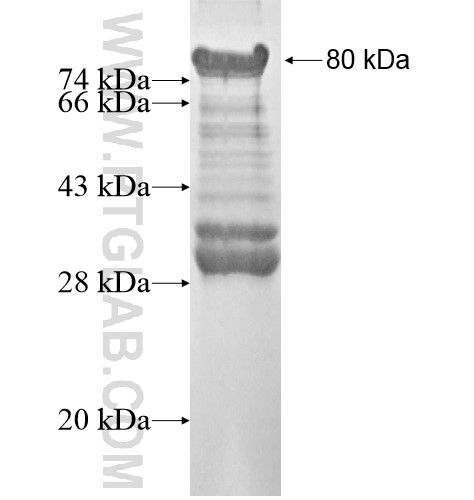 ADNP fusion protein Ag12414 SDS-PAGE