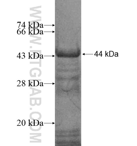 ADNP2 fusion protein Ag12067 SDS-PAGE ADNP2 fusion protein Ag12067 SDS-PAGE