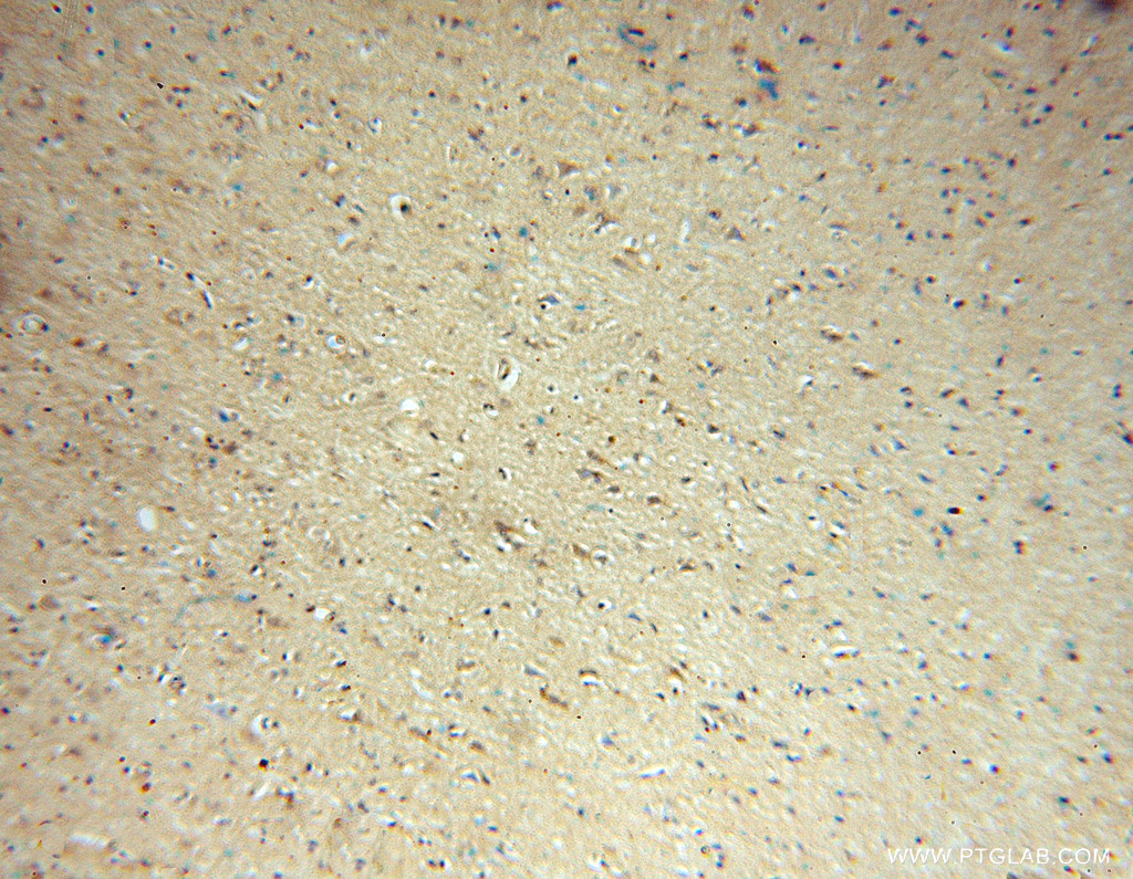 IHC staining of human brain using 16479-1-AP