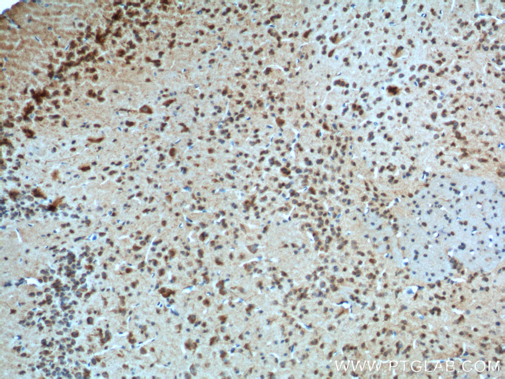 IHC staining of mouse brain using 20332-1-AP