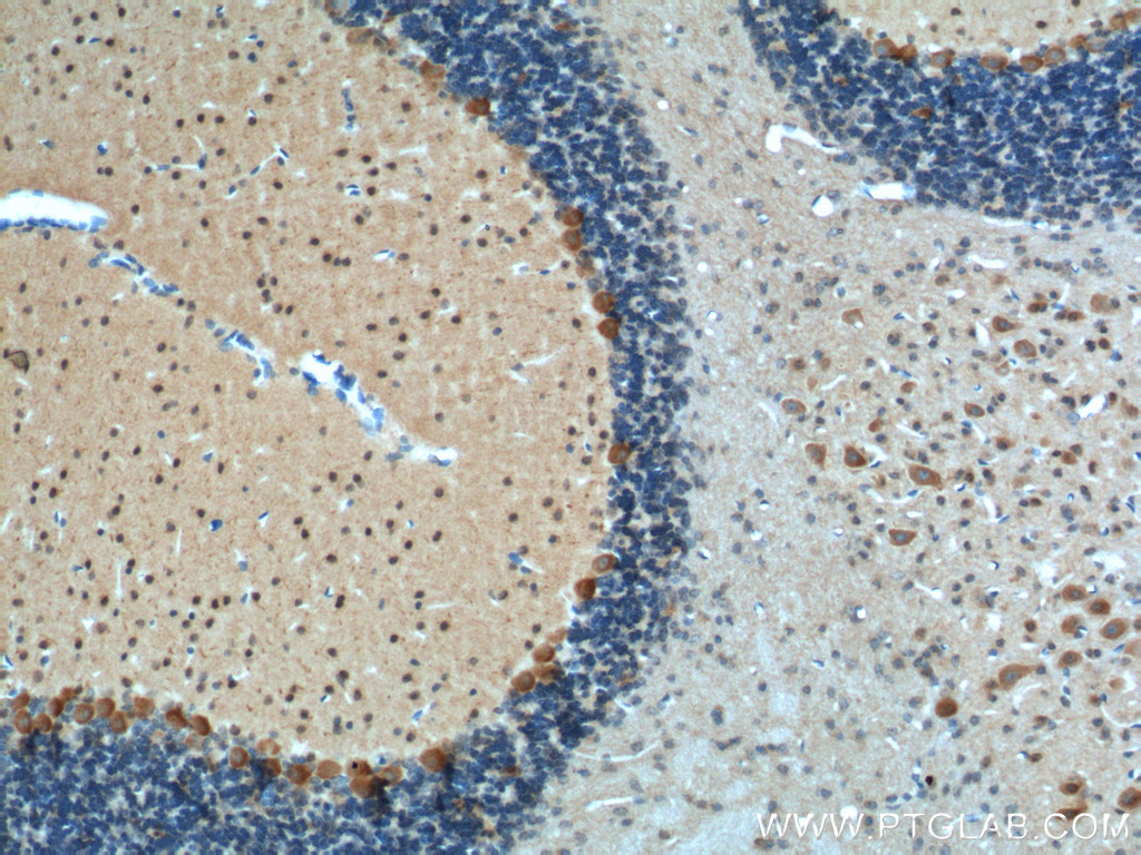 Adenosine A1 Receptor