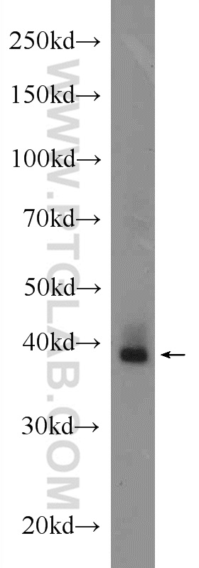 WB analysis of mouse eye using 20332-1-AP