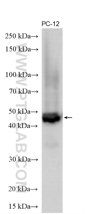 Various lysates were subjected to SDS PAGE followed by western blot with 20332-1-AP (Adenosine A1 Receptor antibody) at dilution of 1:15000 incubated at room temperature for 1.5 hours. WB analysis using 20332-1-AP