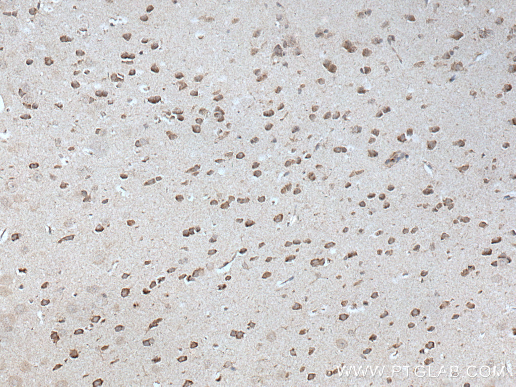 IHC staining of mouse brain using 51092-1-AP