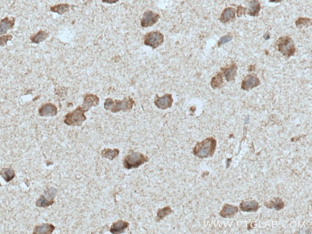 IHC staining of mouse brain using 51092-1-AP