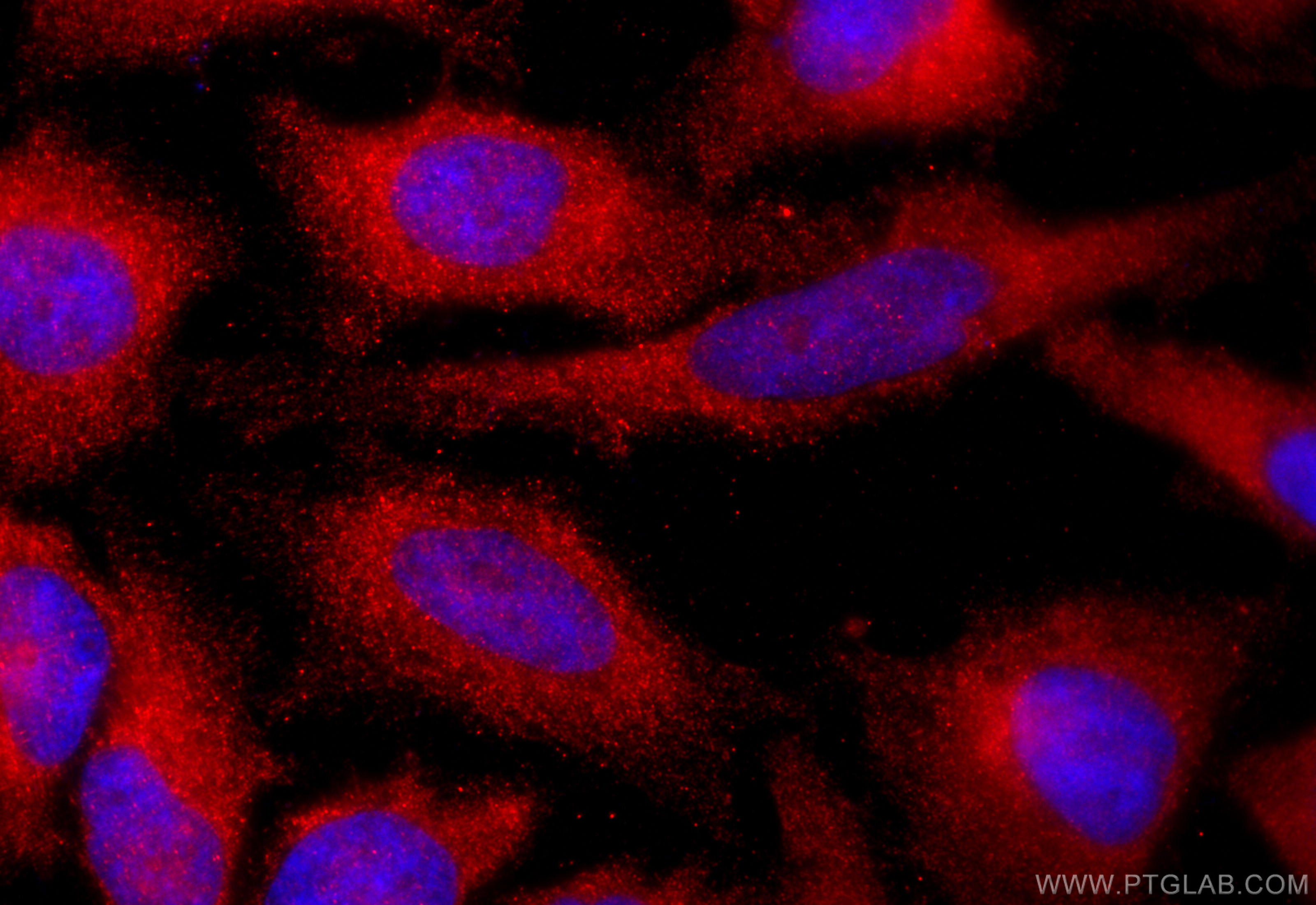 IF Staining of HeLa using 15639-1-AP