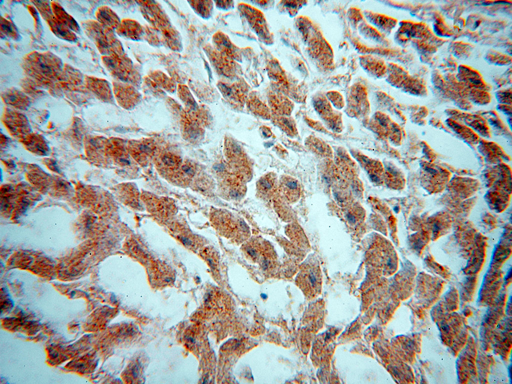 IHC staining of human liver using 15639-1-AP