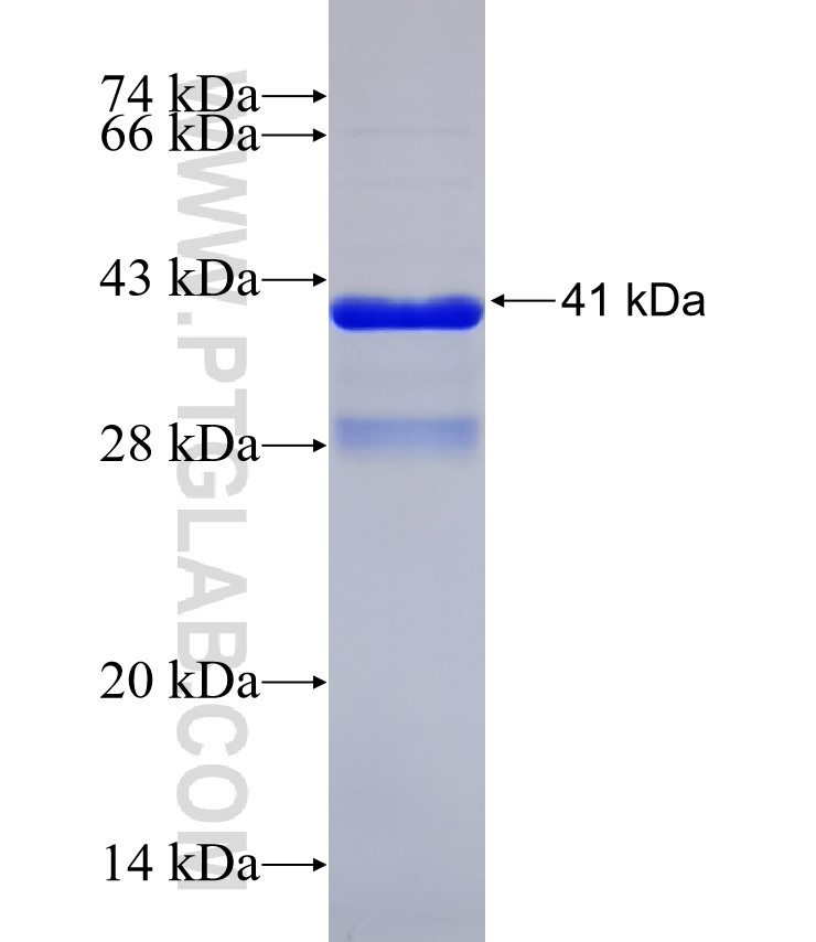 ADPGK fusion protein Ag31225 SDS-PAGE ADPGK fusion protein Ag31225 SDS-PAGE