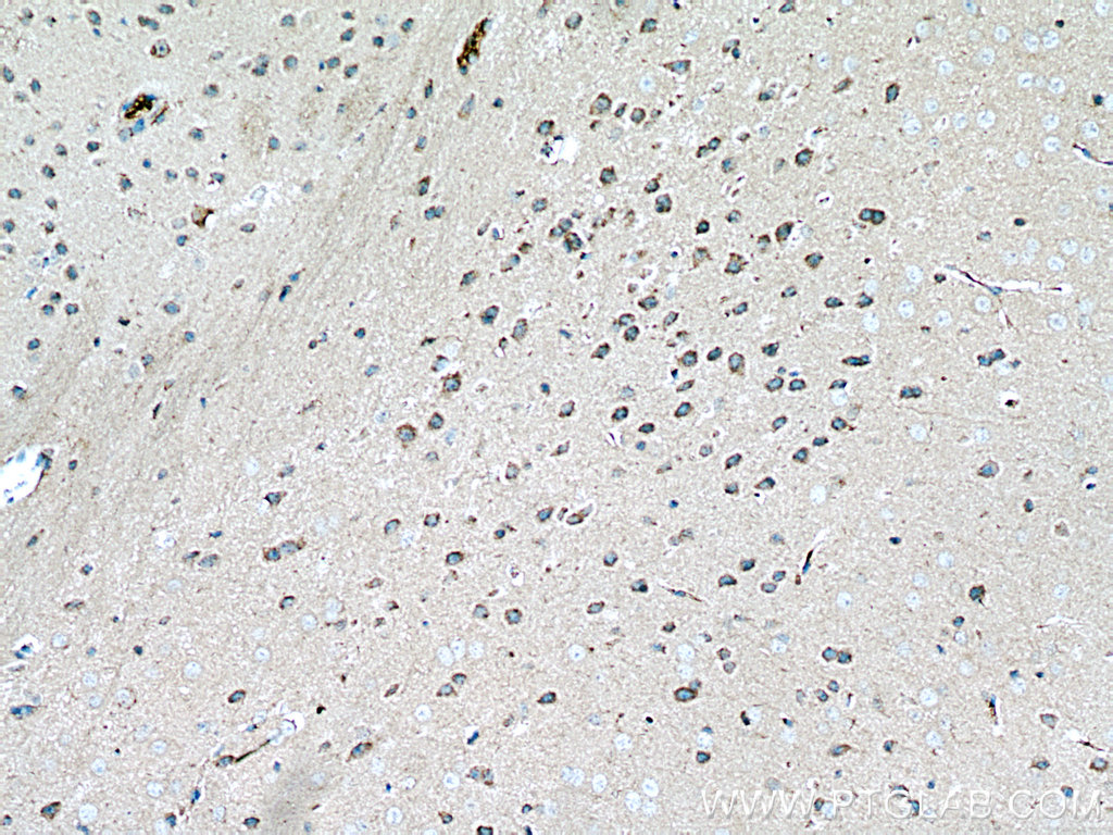 IHC staining of mouse brain using 17911-1-AP
