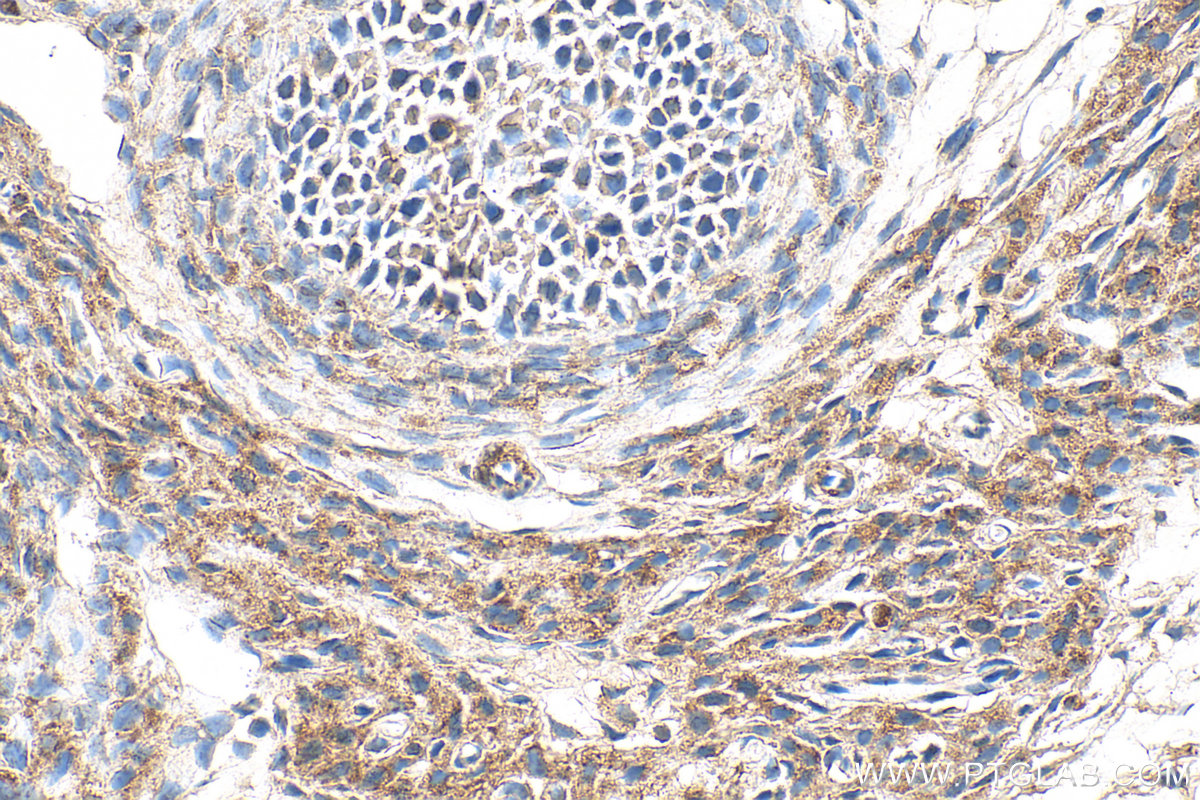 IHC staining of rat ovary using 22419-1-AP IHC staining of rat ovary using 22419-1-AP