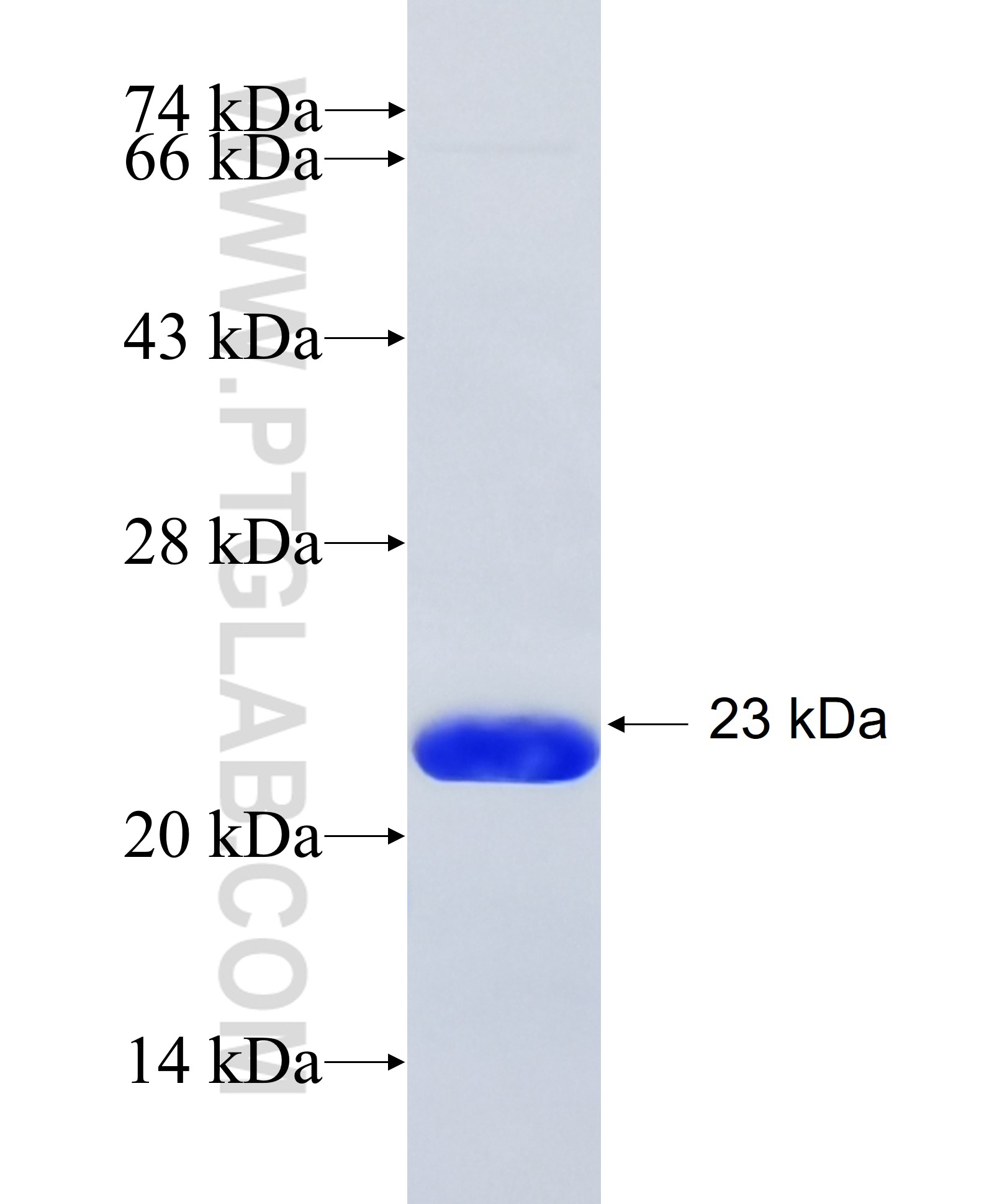 ADRA1B fusion protein Ag35039 SDS-PAGE ADRA1B fusion protein Ag35039 SDS-PAGE