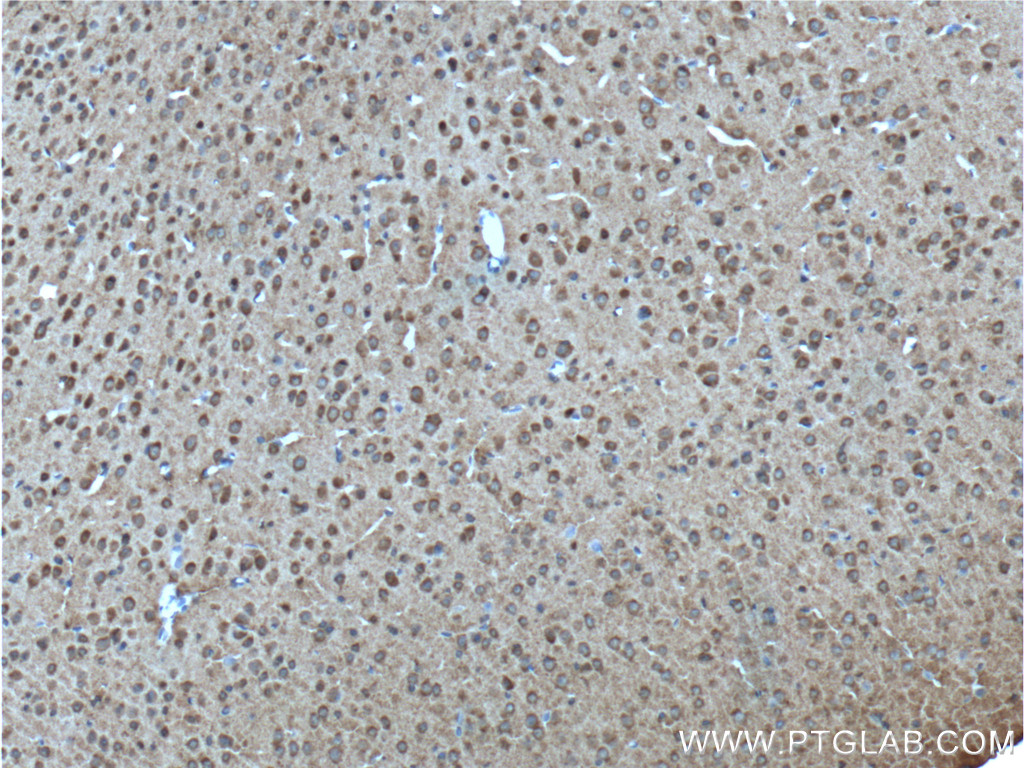 IHC staining of mouse brain using 19776-1-AP