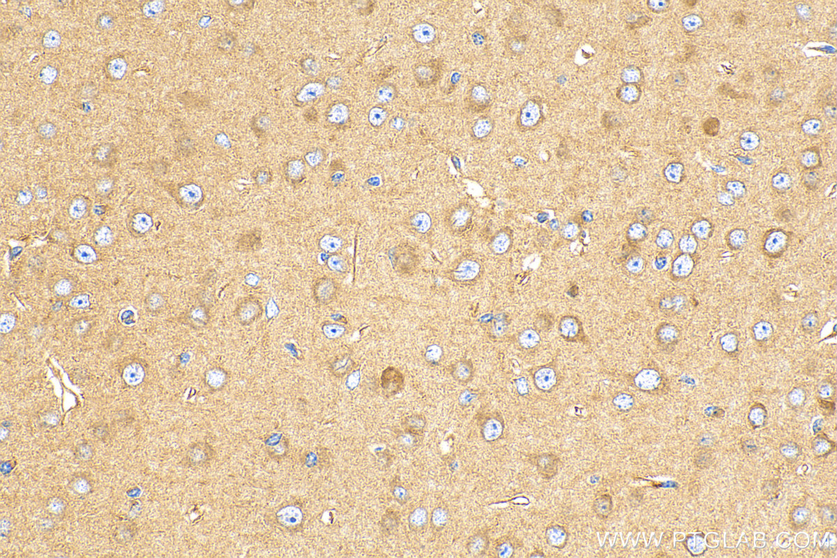 IHC staining of mouse brain using 14266-1-AP
