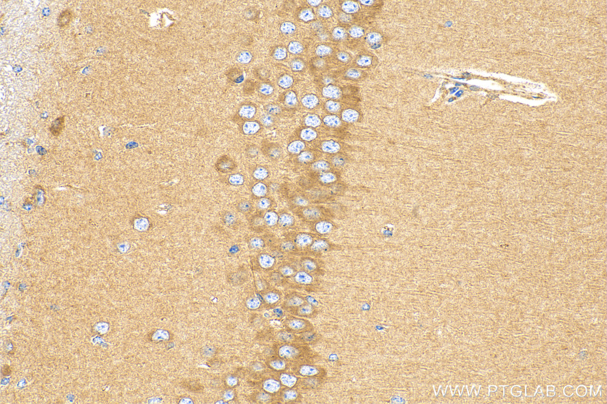 IHC staining of mouse brain using 14266-1-AP