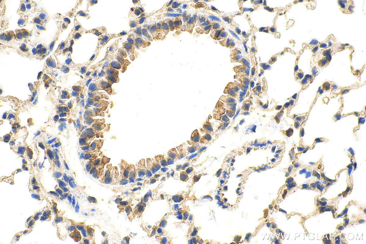 IHC staining of mouse lung using 28323-1-AP