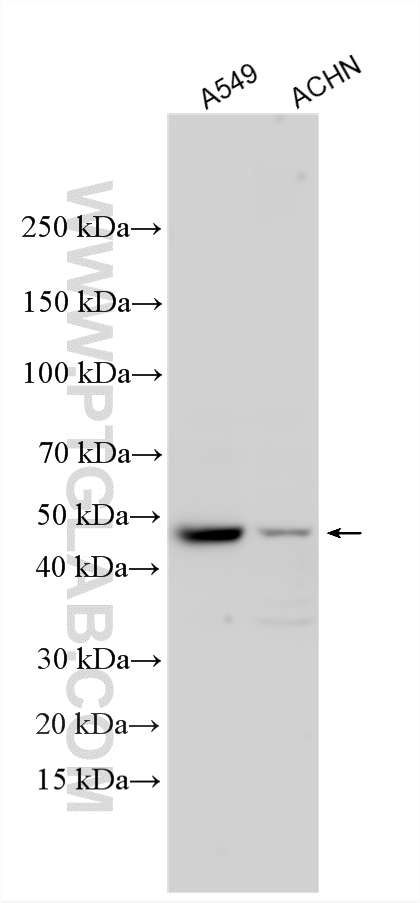 Various lysates were subjected to SDS PAGE followed by western blot with 29864-1-AP (ADRB2 antibody) at dilution of 1:2500 incubated at room temperature for 1.5 hours. WB analysis using 29864-1-AP