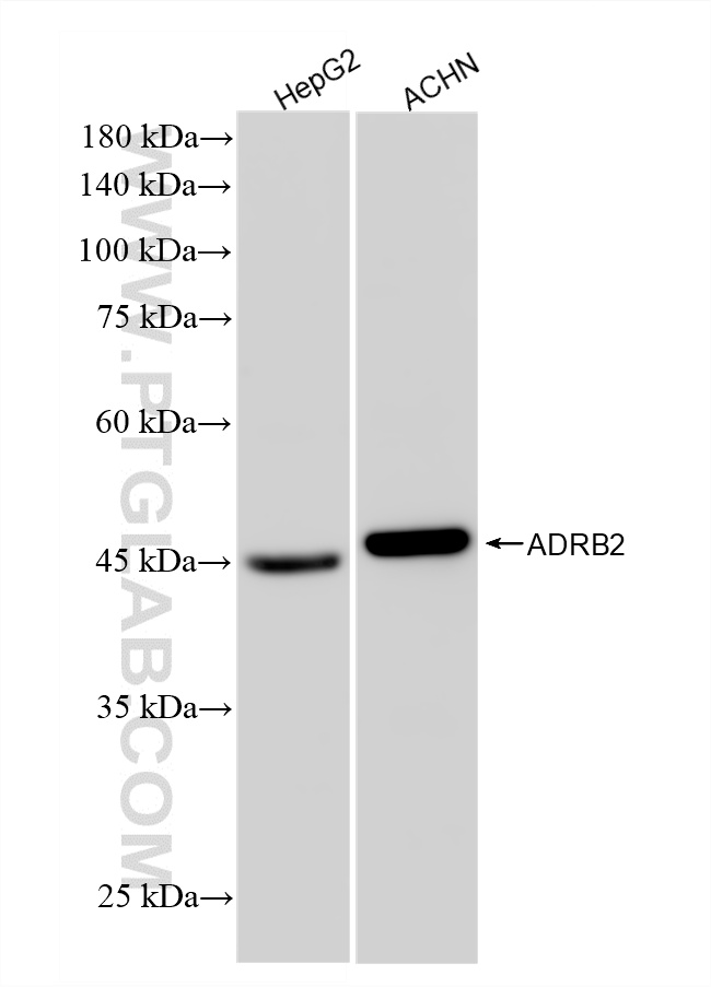 WB analysis using 83317-5-RR