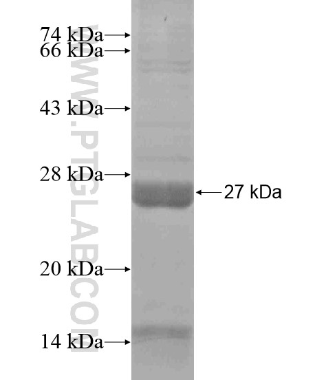 ADRB2 fusion protein Ag18822 SDS-PAGE ADRB2 fusion protein Ag18822 SDS-PAGE