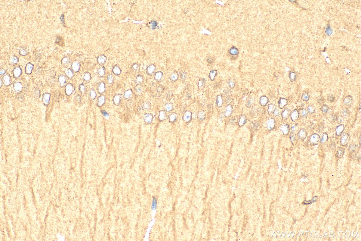 IHC staining of mouse brain using 13990-1-AP